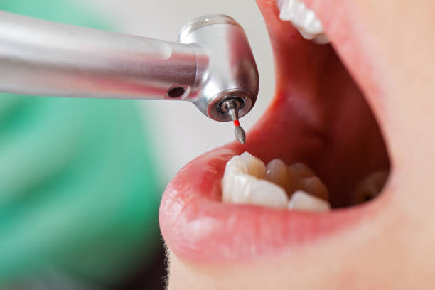 Best After-Hours Dental Care in Jones Valley, CA